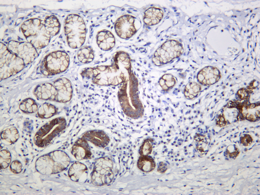 IHC